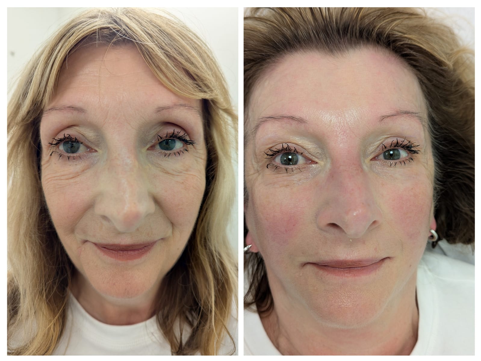 c454fa20 804e 4d0c b55b 816e56cce28a