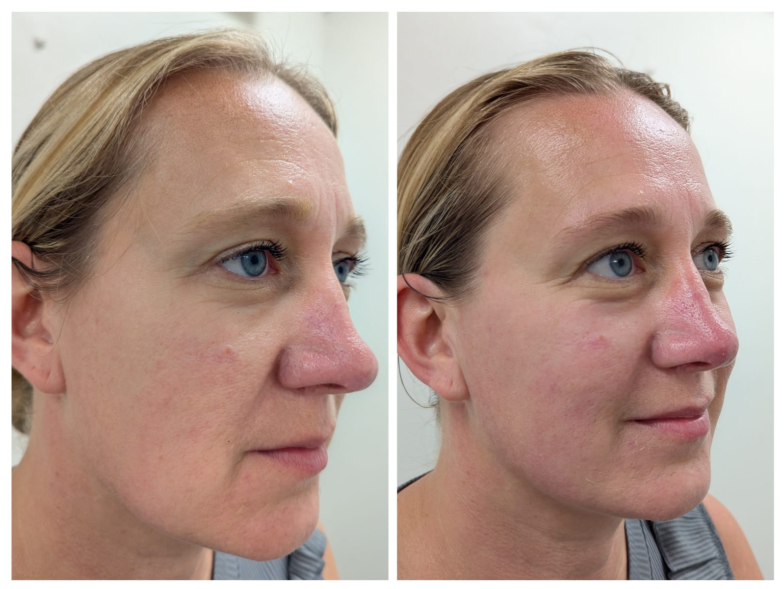 6db5272e 1a46 4c3f a456 ffe20501d3d9