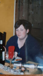 Non Surgical Fat Loss Treatment