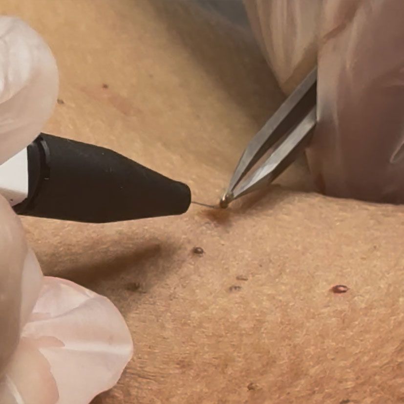 Advanced Cosmetic Procedures