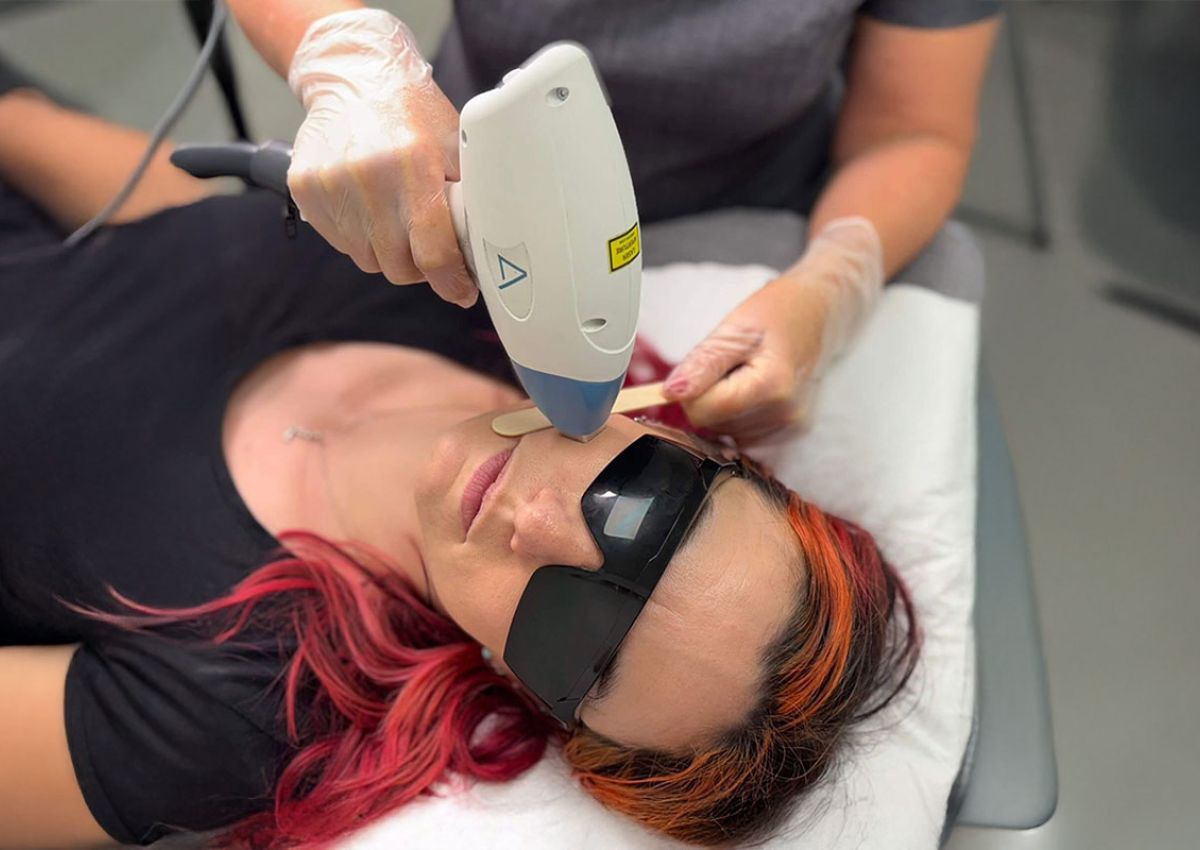 Facial hair removal with a device