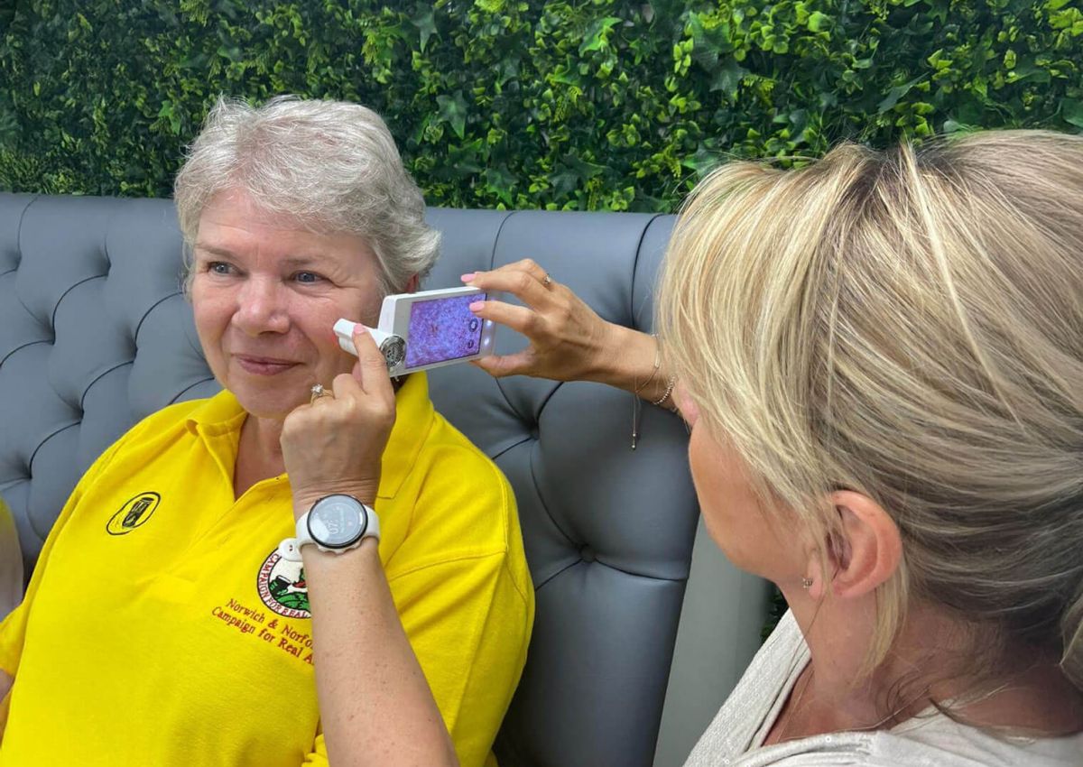 Skin check with device